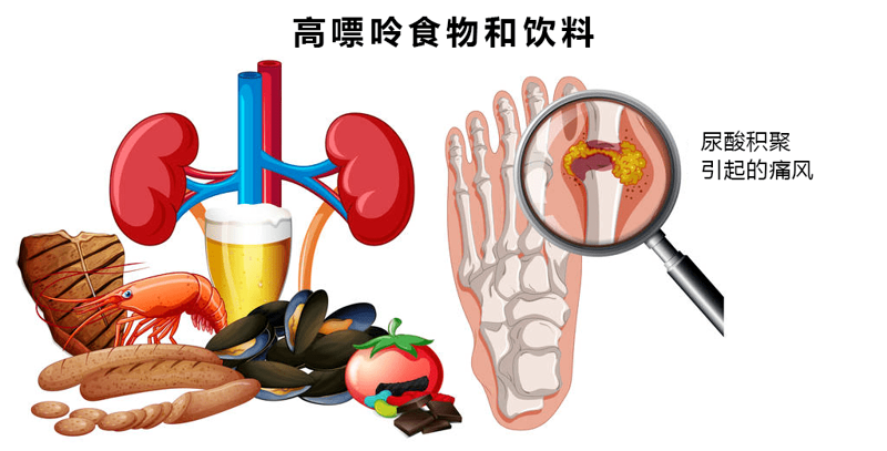 盘锦痛风患者指南：如何科学应对与治疗